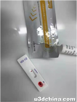 被新闻的HIV感染吓到了 还好是阴性
