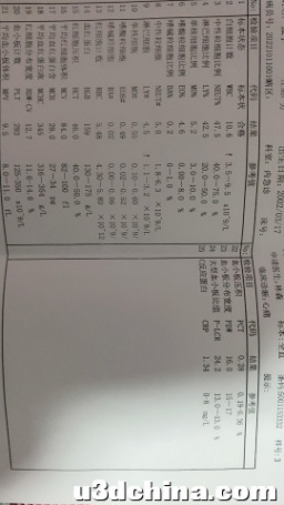 17 岁少年长期熬夜打游戏「多病齐发」险丧命，如何预防游戏 ...